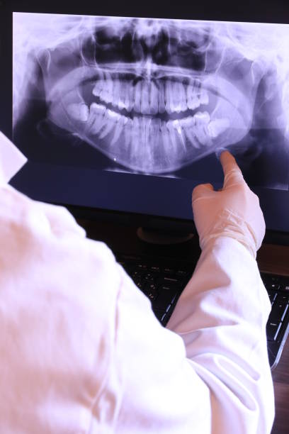 Best Emergency Wisdom Teeth Removal in College Park, MD